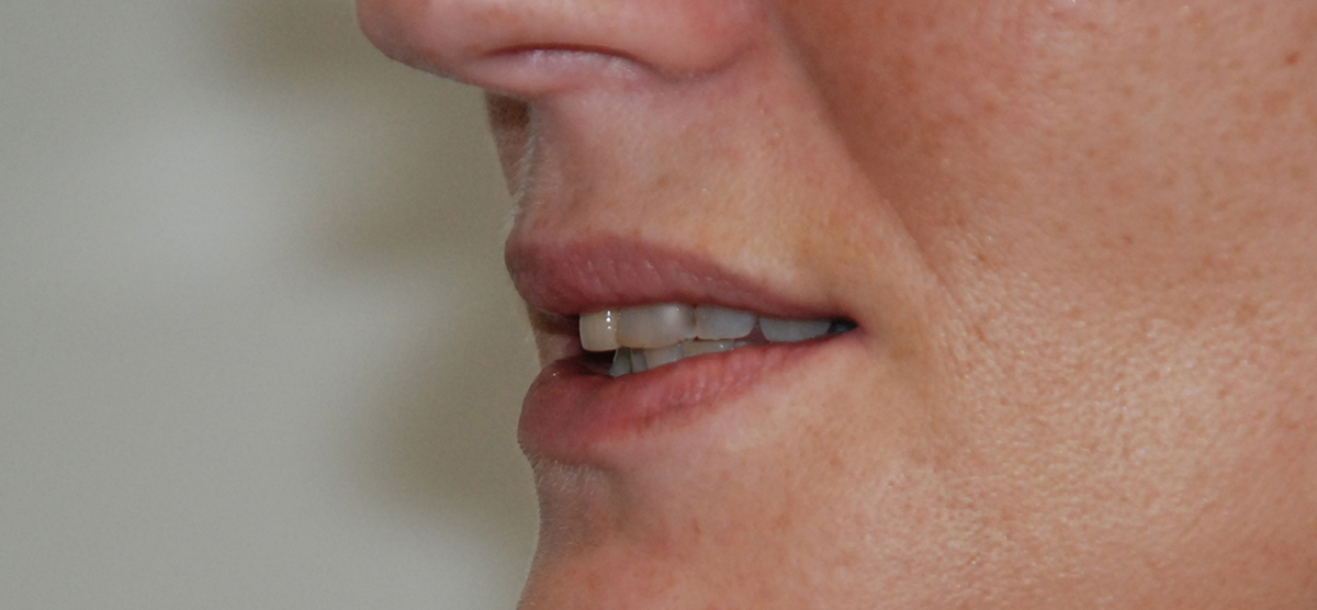 a mouth image