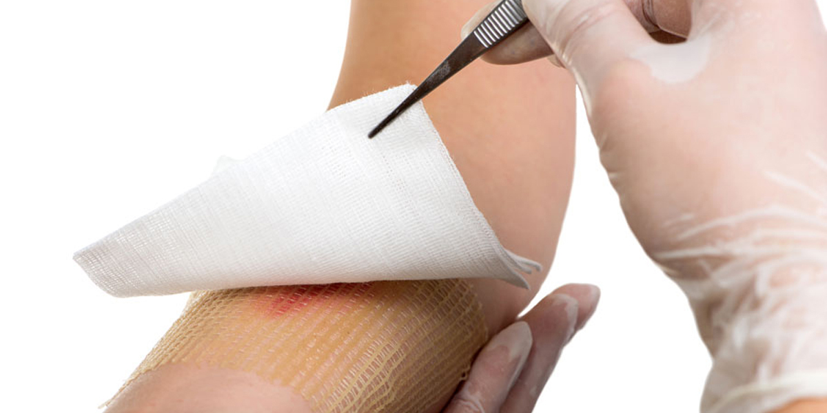 Wound care