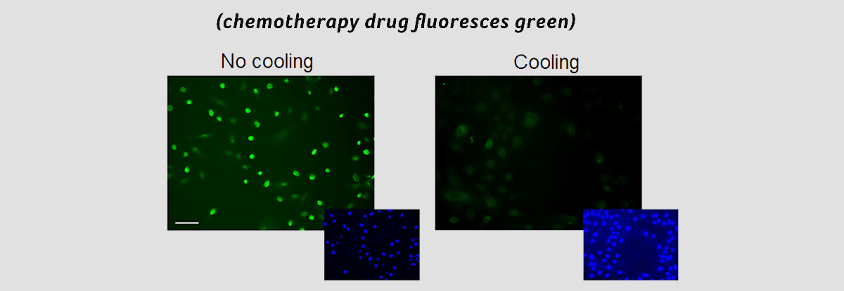 Chemotherapy drug lit up in fluoresces green