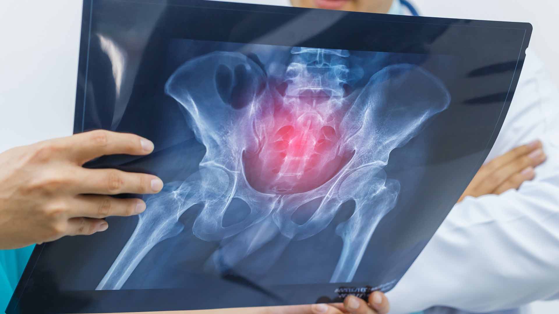 An x ray of a pelvis